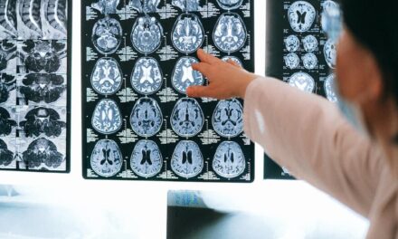 What are the long term social, neurological, cardiovascular and respiratory effects of COVID-19?