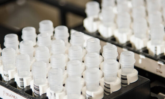 Comparative Review of Efficacy of DPYD Testing