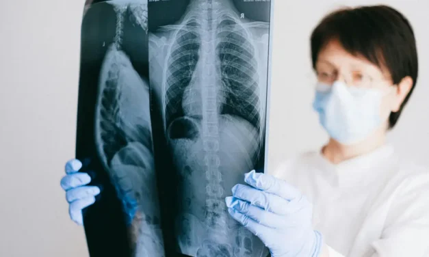 Why Is Lung Cancer in Never-Smokers More Common in Ethnic Minorities and How Can Treatment Be Used to Aid This?