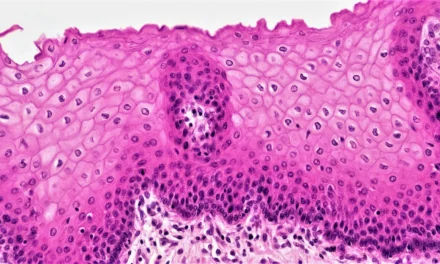 AI-Assisted Skin Cancer Screening: A Review of Diagnostic Accuracy, Real-World Performance and Implementation Considerations