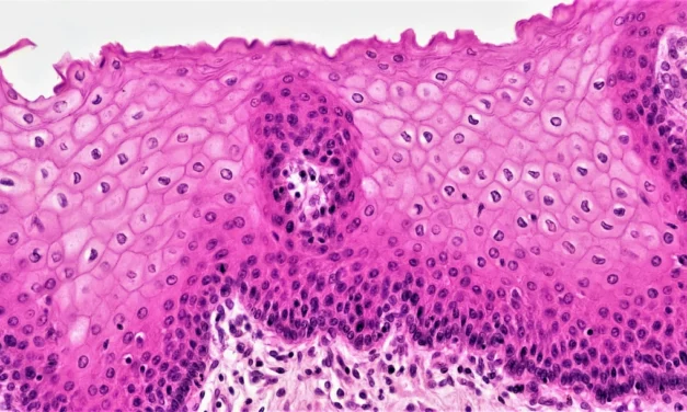 AI-Assisted Skin Cancer Screening: A Review of Diagnostic Accuracy, Real-World Performance and Implementation Considerations